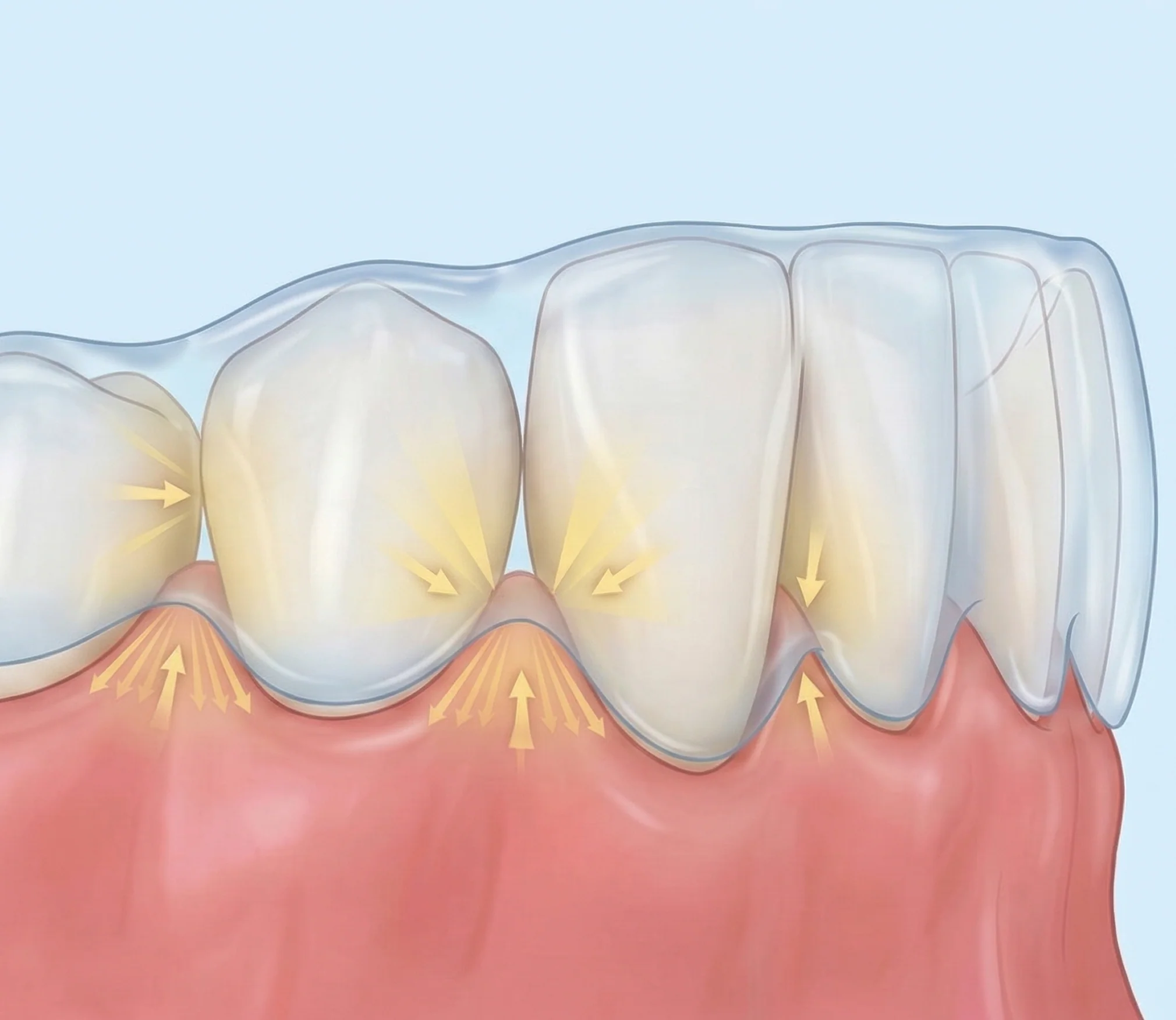 Review Your Smile Projection